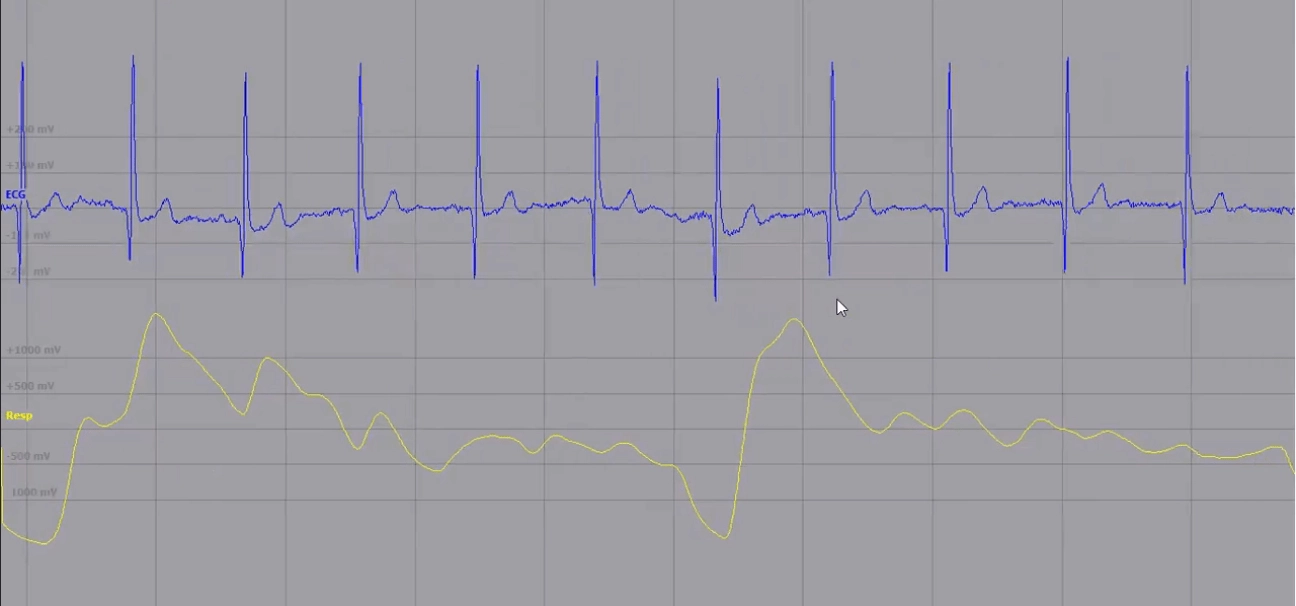 Muscles activity and respiration EDF files